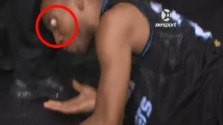 Акил Митчелл получил ужасную травму глаза. Akil Mitchell injured eyes