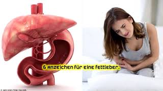 6 Anzeichen für eine Fettleber