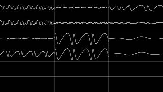 Panel de Pon (Tetris Attack) - "Forest Stage" (MD/Genesis Cover) [Oscilloscope View]