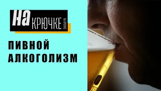 Пивной алкоголизм.