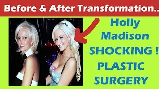 Holly Madison Plastic Surgery Before and After Full HD