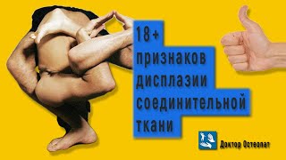 Признаки, по которым легко распознать дисплазию соединительной ткани (ДСТ). (Часть 3)