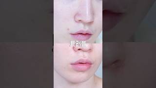 피부과 말고 홈케어로 #트러블 없앤 치트키✨ #올리브영추천템