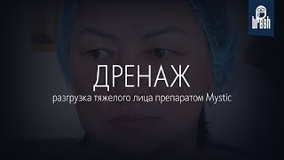 Mystic на дренаж тяжелого лица