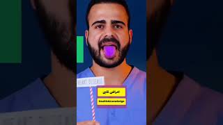 رنگ زبان چه چیزی را نشان می دهد. البته این رنگ ها علل دیگری هم می توانند داشته باشند 