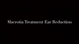 Ear Reduction/ Macrotia/ Otoplasty Surgery. Before, During and After #otoplasty #macrotia