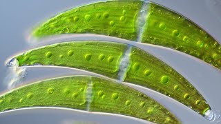 What is Closterium? The Microbe with Dancing Chambers.