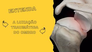 Entenda a luxação traumática do ombro