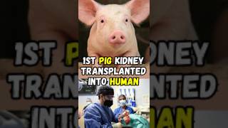 World's 1st Pig Kidney Transplanted into Human #xenotransplantation #shorts #shortsfeed #ytshorts