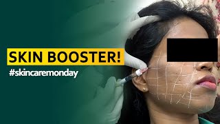 Skin Booster! | Dr. Charanya