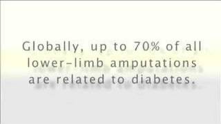 Diabetes Viral