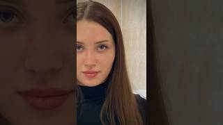 Результат до|после в конце видео #пластиканоса #ринопластика #носыазманова#рино #пластическийхирург