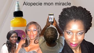 L’alopecie  👉🏿Mon produit miracle#alopecia