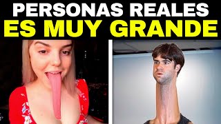 20 Personas Con Partes Del Cuerpo Más GRANDES De Lo Normal