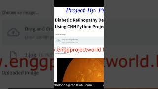 Diabetic Retinopathy Detection Using CNN Python Project Code #shorts