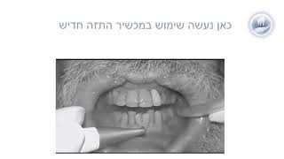 ניקוי שיניים  בבאר שבע  במרפאת השיניים של דר' ריביצקי