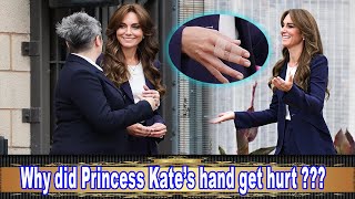 Princess Kate still smiles despite her injured hand .Do you know what happened to her?