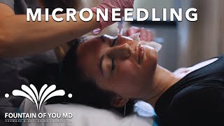 Discover the Benefits of Microneedling | Fountain of You MD