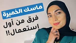 ماسك الخميرة وصفة سحرية لنضارة وشد البشرة! قولي وداعًا للتجاعيد 😉😉