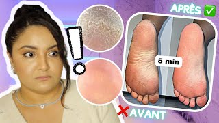 COMMENT AVOIR DES PIEDS DOUX ET LISSES EN 5 MIN ! — Ma routine pieds (LOVASKIN)