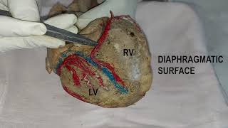 Dissection: Heart Blood Supply