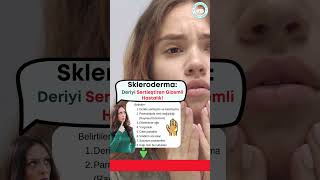 Skleroderma: Deriyi Sertleştiren Gizemli Hastalık! #Skleroderma #CiltHastalığı #BağDokusuSorunu