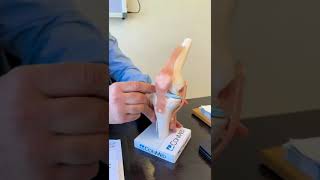 osteoarthritis خشونه المفاصل