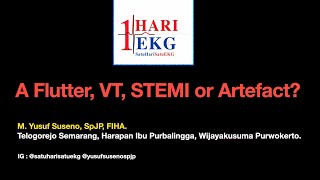 Atrial Flutter, VT Polimorfik, STEMI, or Artefact??