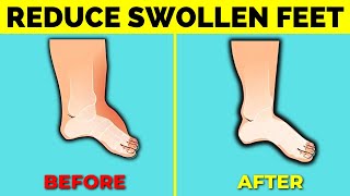 Home Remedies for Swollen Feet