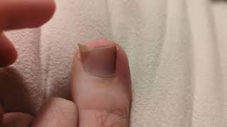 toenail 29