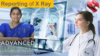 Reporting X-ray | advancement