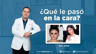 ¿Qué le pasó en la cara? - Kylie Jenner