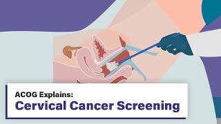 ACOG Explains: Cervical Cancer Screening