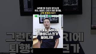 MRI에 별 이상이 없다는데 허리, 엉덩이, 다리가 아픈 환자들, 근육 문제라구요!!! #shorts