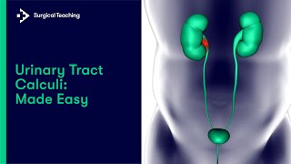 Urinary Tract Stones | All you need to know