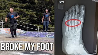 I broke my foot skateboarding...