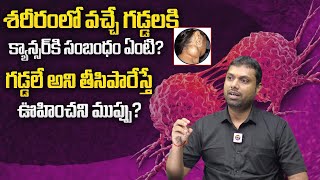 చర్మం మీద క్యాన్సర్ గడ్డలు ఎలా గుర్తించాలి? | Cancer Tumor | Cancer Pain Management | Dhatri Health