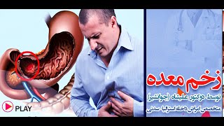 چرا زخم معده نزد افراد بوجود می آید؟ کدام عوامل سبب بوجود آمدن زخم معده نزد افراد می گردد