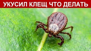 УКУСИЛ КЛЕЩ, ЧТО ДЕЛАТЬ ПЕРВАЯ ПОМОЩЬ В ДОМАШНИХ УСЛОВИЯХ