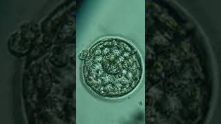 A blastocyst that has been in "cryosleep" for a year is being prepared for embryo transfer #icsi