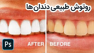 چطور دندان ها را در فتوشاپ سفید کنیم؟ - How to Whiten Teeth in Photoshop