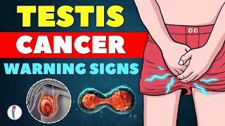 Testicular Cancer Warning Signs You Shouldn't Ignore | Cancer | Testicular Cancer Symptoms