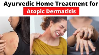 ATOPIC DERMATITIS or Eczema AYURVEDIC Home Treatment