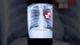 X Ray 😱 #shorts #shortsviral #funny #funnyreels #comedyvideo #shortsvideo #viralshorts #trending #yt