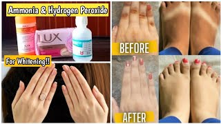 Proven remedy to get white Hand & Feet (using only Three things)