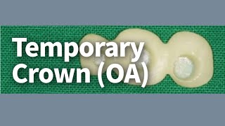 Temporary crown(OA)(ENG)