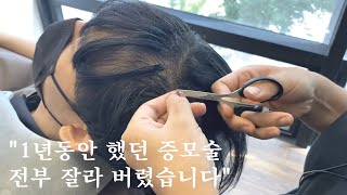 본드로 붙여진 헤어증모술 모두 잘라냈습니다 /증모술부작용/증모술단점/