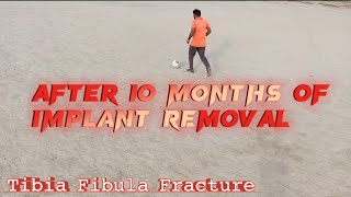 Back To Normal Life ||After 10 Months Of Amplat Removal || Tibia Fibula Fracture Recovery ||