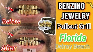 Pullout Grillz |Benzino Jewelry #floridagolds