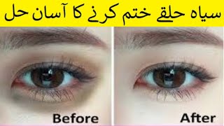 بلیک ڈارک سرکل ختم کرنے کا آسان حل - #healthtips #healthtipsinhindi #healthtipsvideo #eyetips